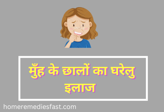 Home Remedies for Mouth Ulcer in Hindi